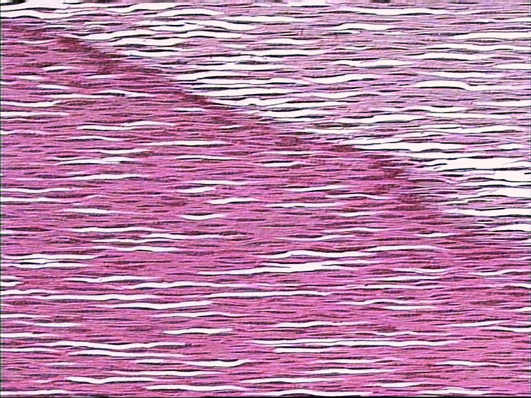 AbiesT.jpg (167320 bytes)