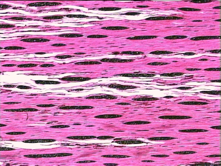 AbiesT.jpg (167320 bytes)