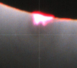 protuberance3.jpg (12923 bytes)