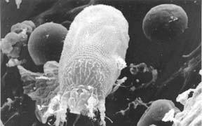 mite and eggs