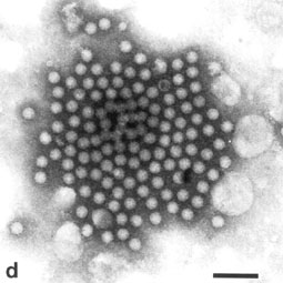 Seeing is Believing - Electron microscopy in diagnostic and biological ...